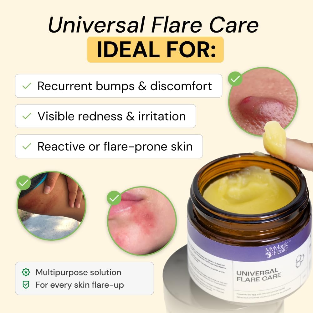 MyMagicHealer Universal Flare Care – Multi-Purpose Solution | Skin Flare-Ups - Hidradenitis Suppurativa, Folliculitis, Boils, Cysts | Anti-Chafing | Irritated Skin Relief w/Propolis & Egg Yolk 1 oz