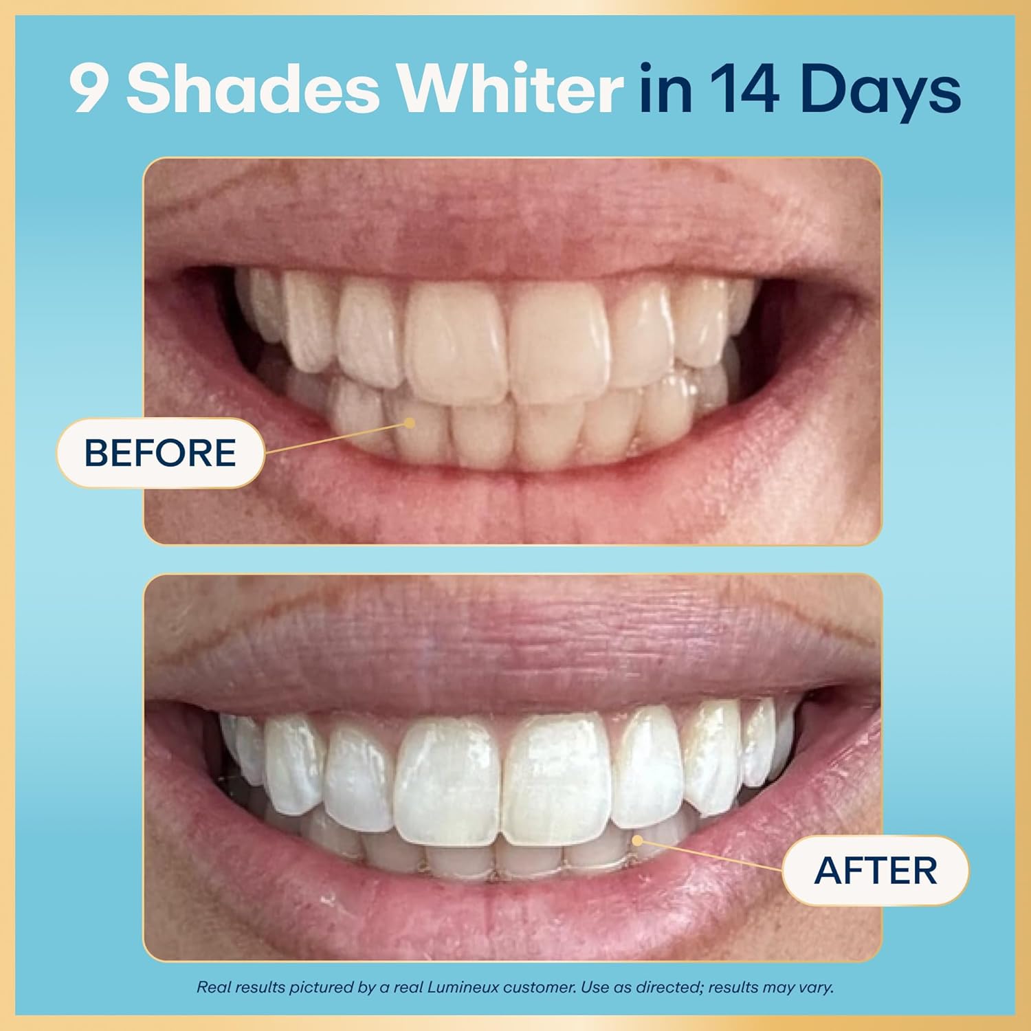 Lumineux Teeth Whitening Strips Kit - 9 Treatments (1 Month) - Peroxide Free - Enamel Safe for Whiter Teeth - Whitening Without The Sensitivity - Dentist Formulated - Sensitivity Free