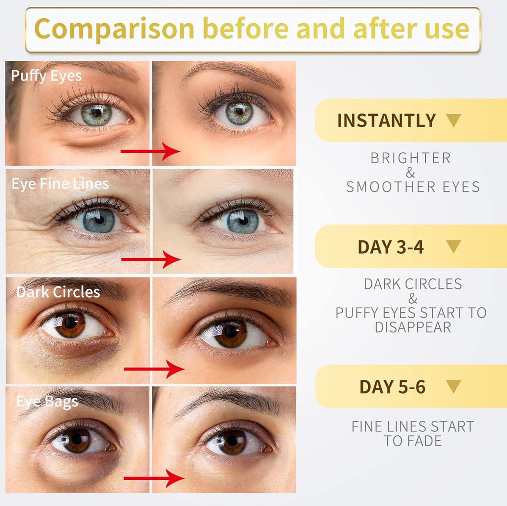 NAZANO 24K Gold Under Eye Patches - 60 Pack for Puffy Eyes, Dark Circles, Bags & Wrinkles with Collagen & Hyaluronic Acid - Eye Care Pads for Daily Skincare (Gold)
