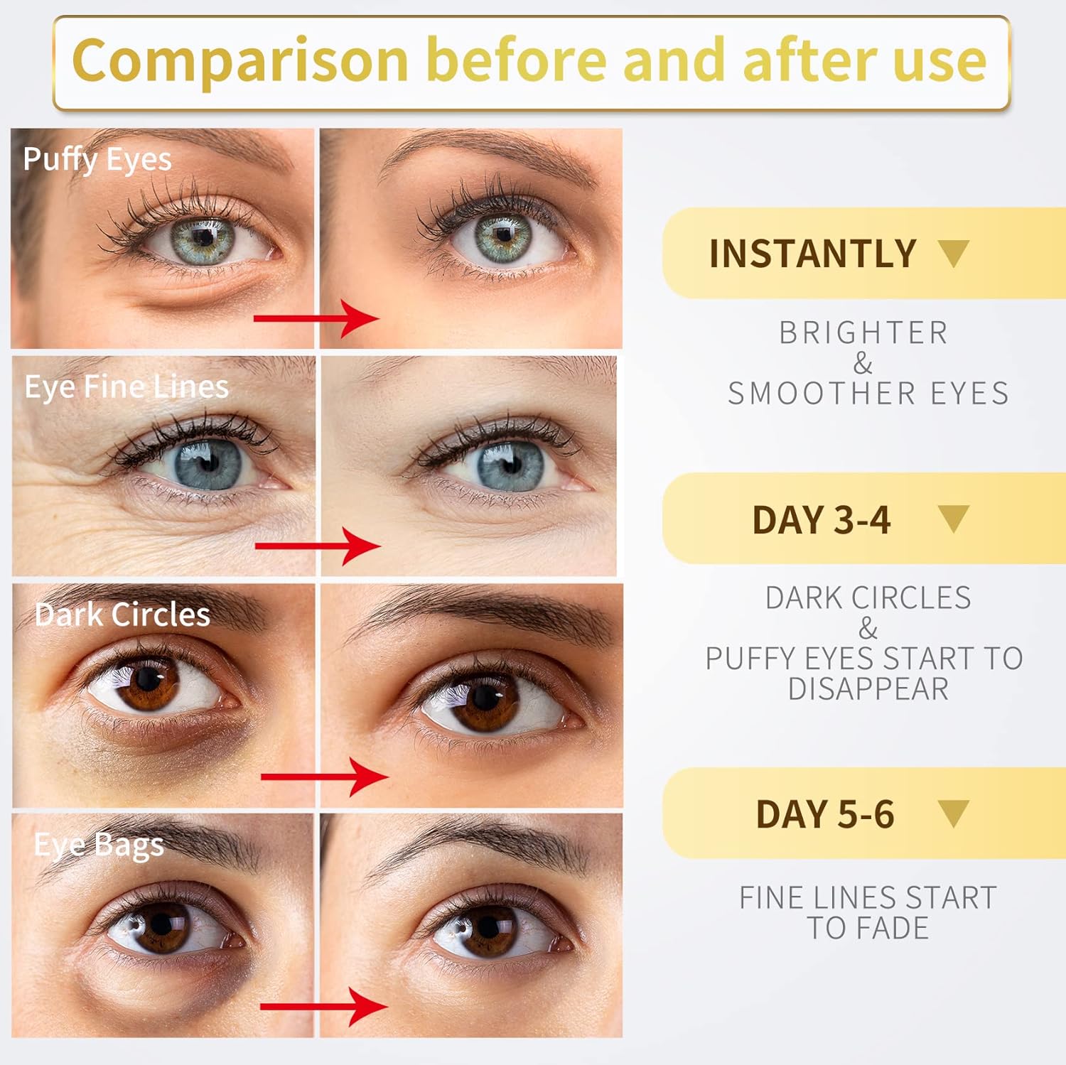 NAZANO 24K Gold Under Eye Patches - 60 Pack for Puffy Eyes, Dark Circles, Bags & Wrinkles with Collagen & Hyaluronic Acid - Eye Care Pads for Daily Skincare (Gold)